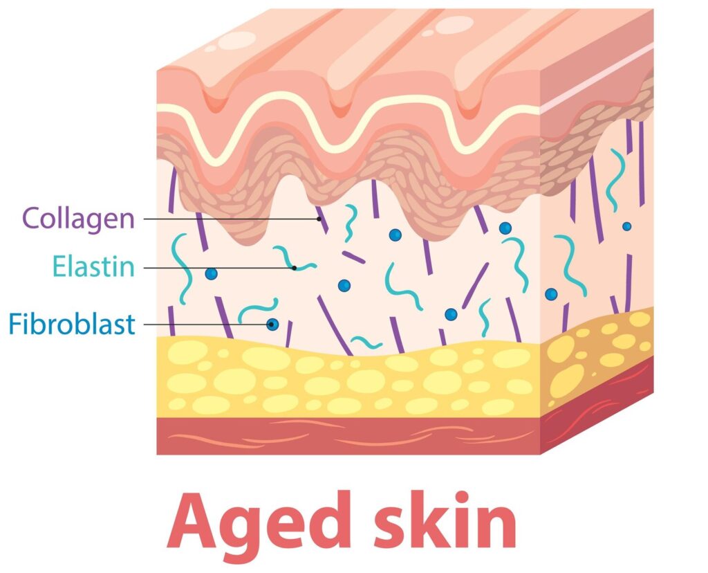 aged-skin-crosssection-diagram_1308-172071